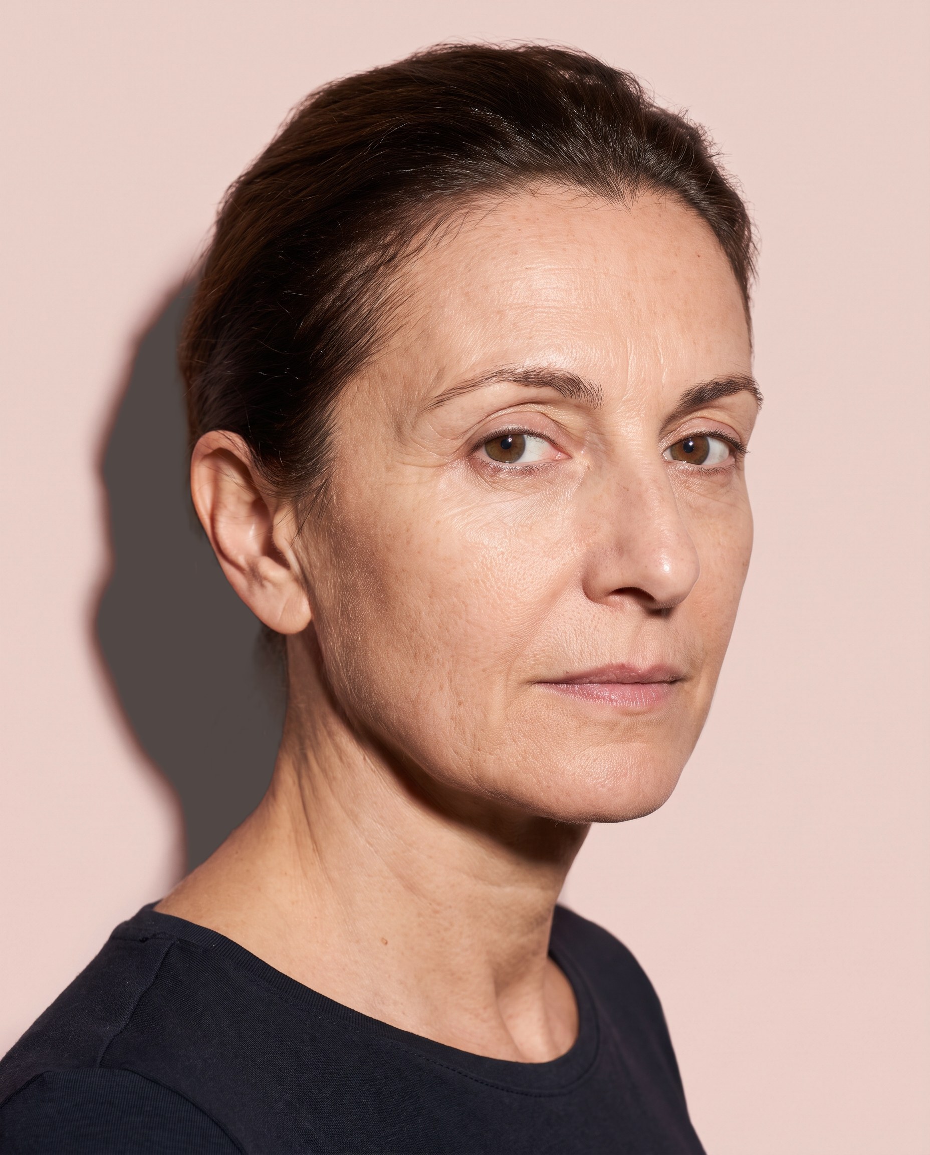Filler tempie: la zona che si tratta